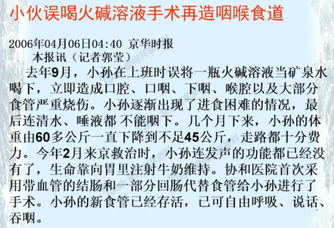 作死！研究生用實驗室里的燒杯沖咖啡，喝完就進了醫院搶救