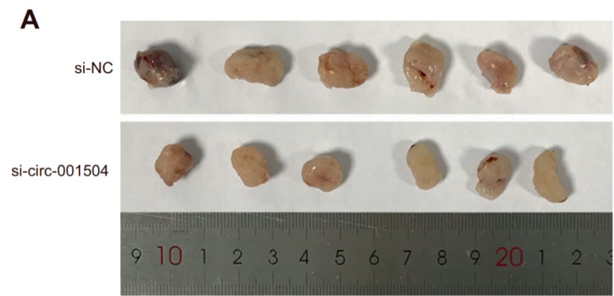 4篇SCI共用一把鋼尺遭撤稿！涉及多所985，包括多位院長(zhǎng)、重點(diǎn)專科負(fù)責(zé)人…